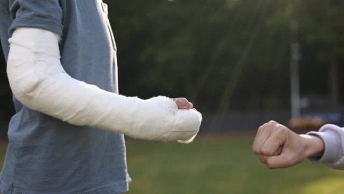 在夏日用拳头迎接另一个男孩的男孩断手的短拍。肢体骨折显示。手臂上的石膏。友谊。毁了暑假。