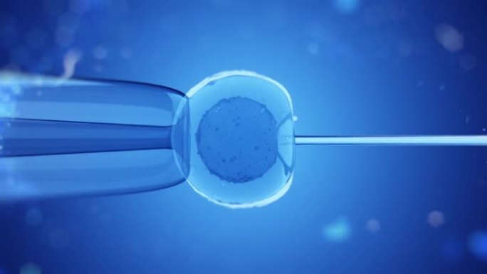体外受精IVF分娩虚弱子宫内膜异位症