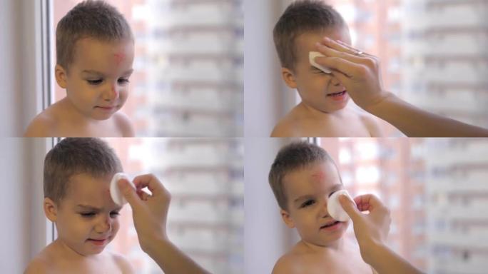 一位有爱心的母亲计划在她2岁儿子的鼻子上刮擦和颠簸时使用杀菌剂霜。一个小男孩在炎热的夏日在操场上跑步