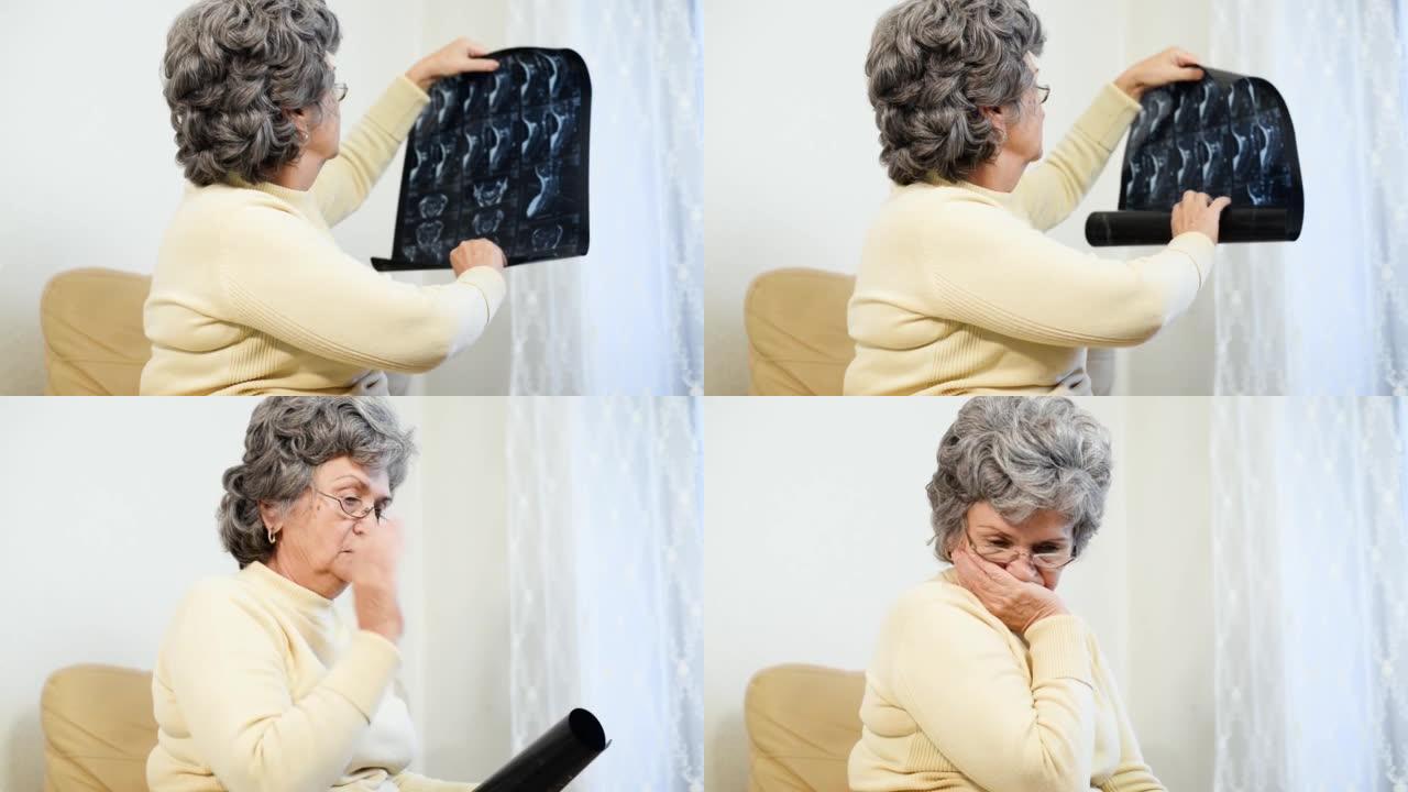 老年妇女病人坐在室内检查脊柱x光。成熟的女人因体检结果而心烦意乱。老年人和医疗保健，放射线照相，骨骼