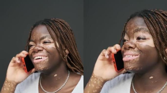 特写镜头，一名患有白癜风的非洲裔美国妇女在电话交谈时微笑。