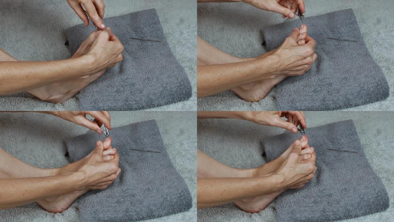 修剪脚趾甲的角质层。去除脚趾上的旧皮肤。