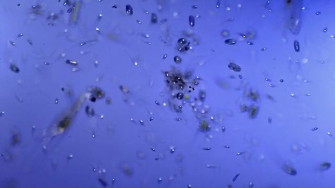 纤毛虫微生物菌落显微镜下微生物病毒细菌