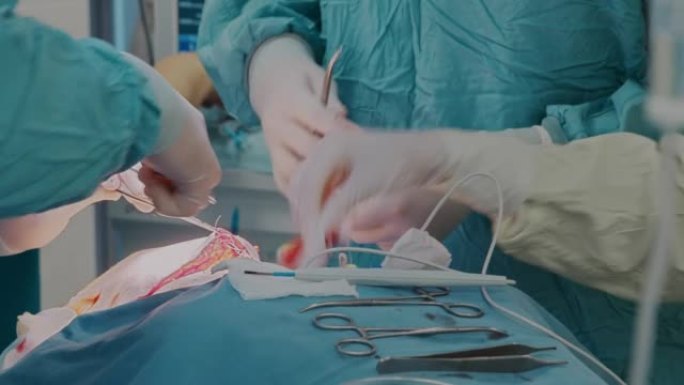 医疗小组用医用线，医用剪刀和镊子对淋巴结进行手术