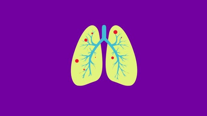 肺水肿的数字动画，非常危险的病毒符号