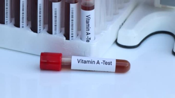 实验室检测维生素a的血液样本