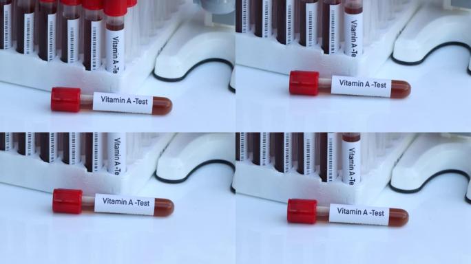 实验室检测维生素a的血液样本