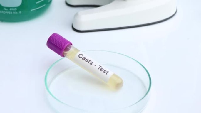 实验室测试铸型的尿液样本