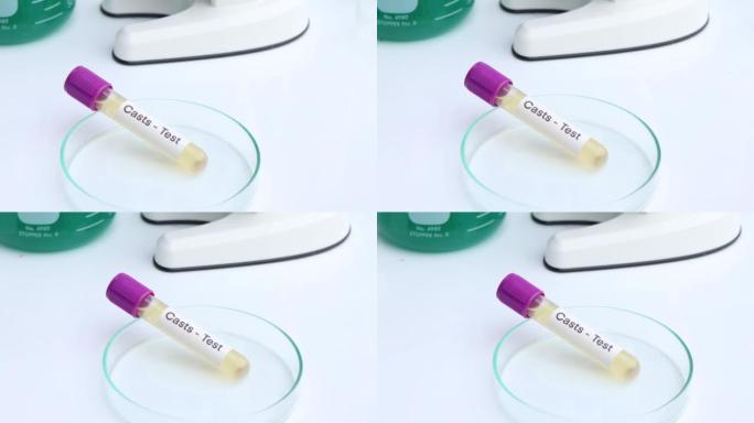 实验室测试铸型的尿液样本