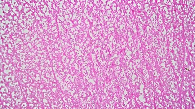 脊髓细胞TS显微样品400倍放大着色粉红色