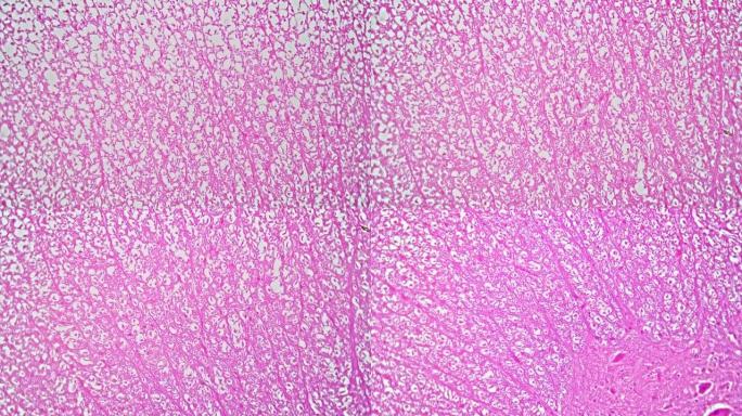 脊髓细胞TS显微样品400倍放大着色粉红色