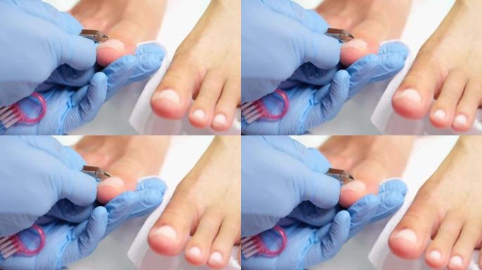 修脚大师在修脚沙龙使用指甲钳切割脚趾甲
