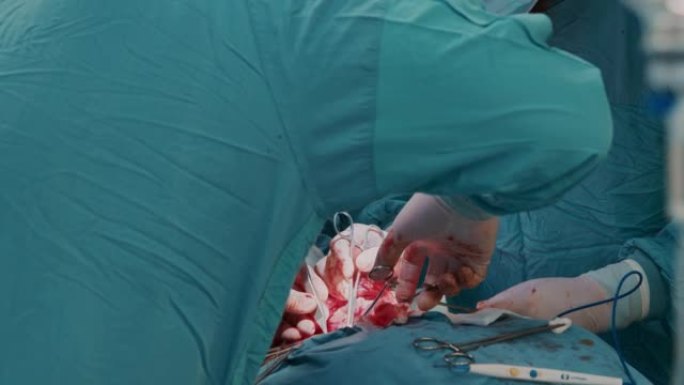 医疗小组用医用剪刀和镊子对淋巴结进行手术