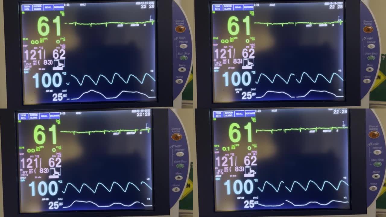 计算机屏幕医院设备监控手术室中的生命功能 (生命体征) 监视器视频系列