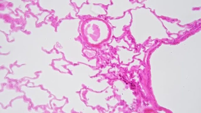 光场放大400倍显微镜下肺组织切片