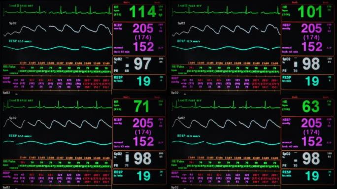 生命体征波形心电图心率心脏死亡生命体征监