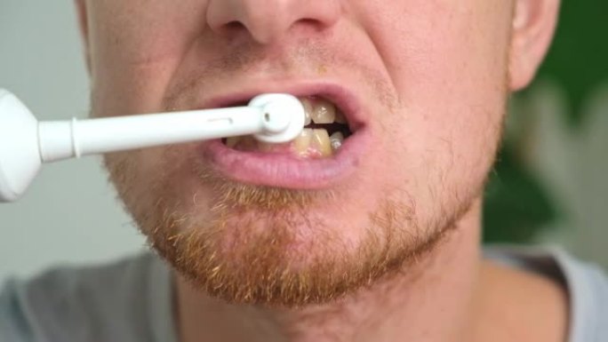 一个留着红胡子的年轻人正在用白色电刷刷牙。口腔护理。