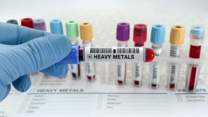 实验室技术员持有血液测试超过重金属测试申请报告