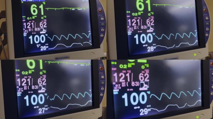 计算机屏幕医院设备监控手术室中的生命功能 (生命体征) 监视器视频系列
