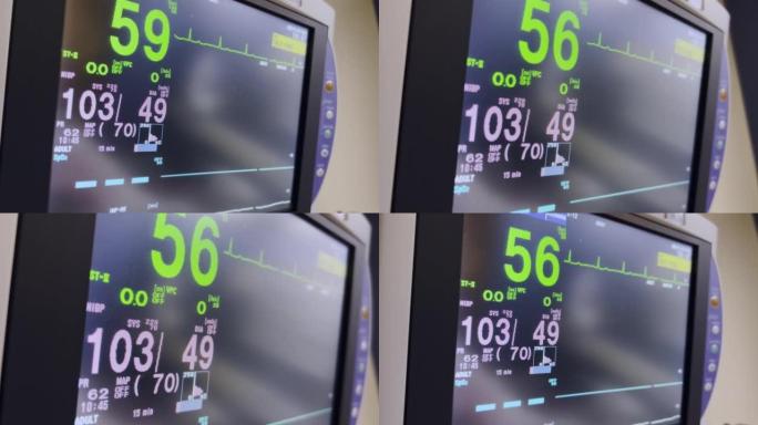 计算机屏幕医院设备监控手术室中的生命功能 (生命体征) 监视器视频系列