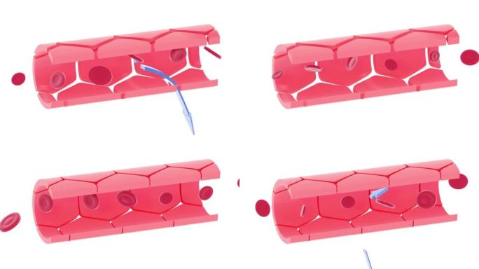 动脉毛细血管部分的3d动画。