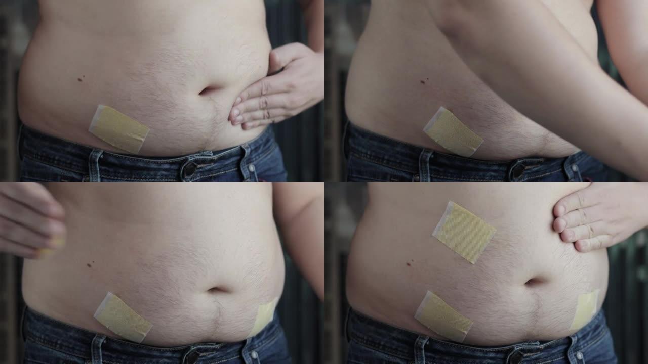一名男子为了减肥，在腹部贴了一块黄色的减肥脂肪燃烧贴。特写，慢镜头