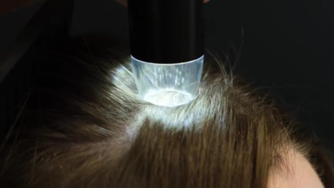一名专业的毛发学家使用皮肤镜检查一名年轻女子的头部。