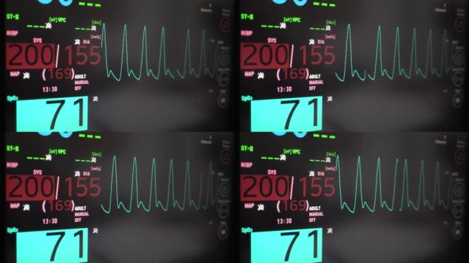 生命体征监护仪ICU抢救