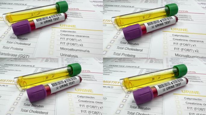 带血和尿液的管子分析测试要求文件