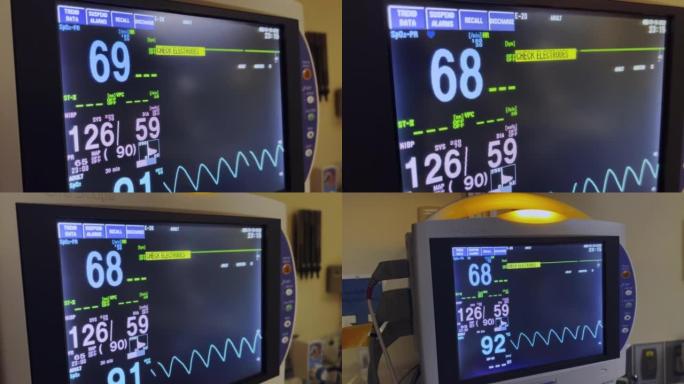 计算机屏幕医院设备监控手术室中的生命功能 (生命体征) 监视器视频系列