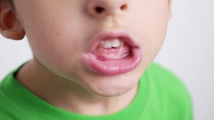 穿着绿色t恤的特写肖像男孩儿童展示了他的嘴，没有正面的乳牙，并在镜头前展示了一颗牙齿，站在房间的白色