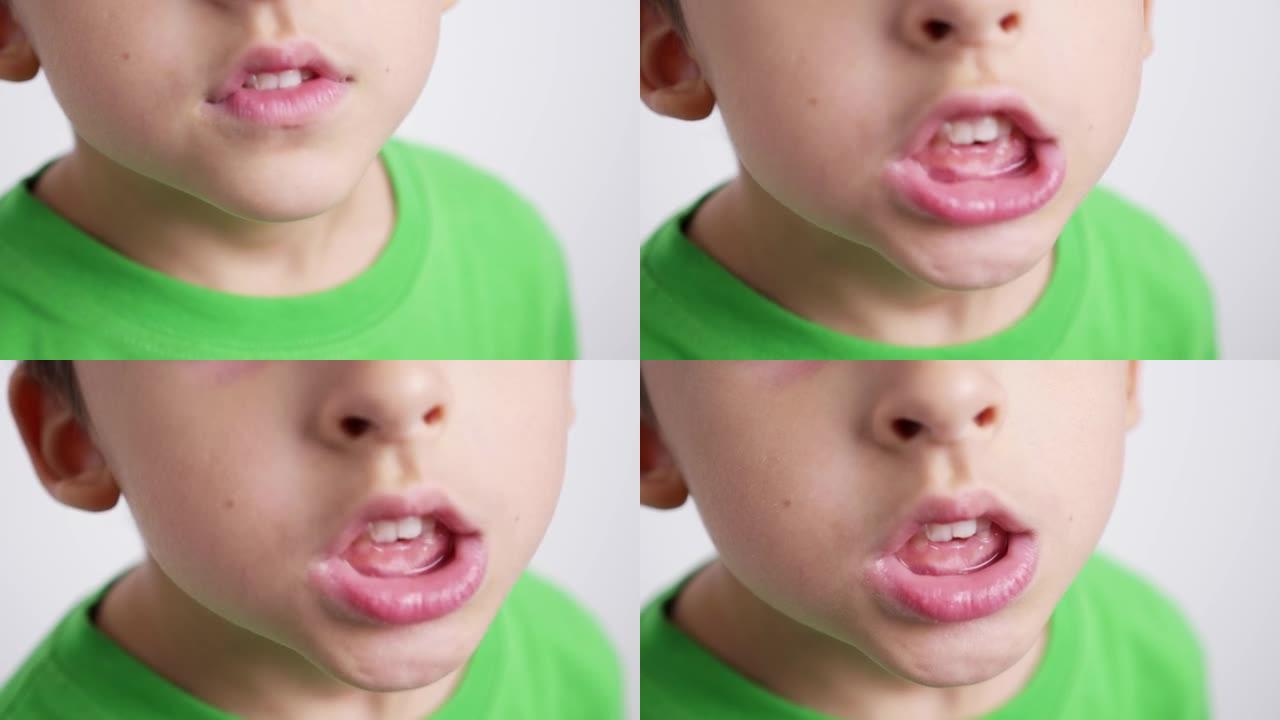穿着绿色t恤的特写肖像男孩儿童展示了他的嘴，没有正面的乳牙，并在镜头前展示了一颗牙齿，站在房间的白色