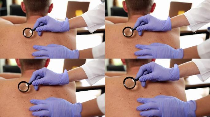 肿瘤学家用放大镜检查成人皮肤上的肿瘤