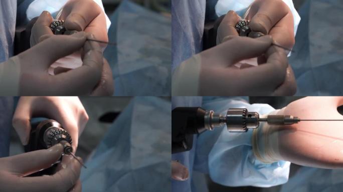 外科医生用一只手戴上医用手套，将钻头插入钻头并固定。医生通过用螺栓和手术钻头固定骨骼来进行整形外科手