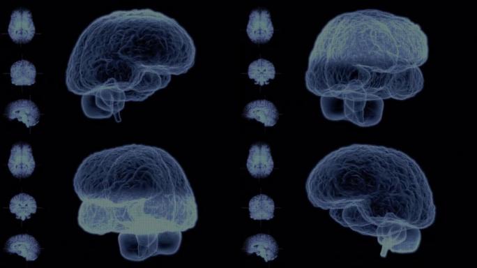 人脑-脑扫描-可循环