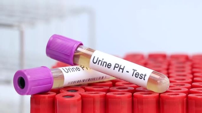 尿液酸碱度检测从尿液中寻找异常，在实验室进行尿液样本分析