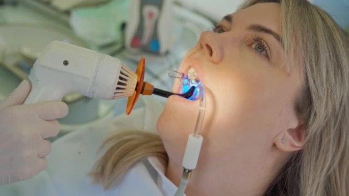 用灯对口腔中的填充物进行巴氏消毒，对女性的口腔和牙医的手进行特写。口腔医学。牙科治疗。医生治疗一名年