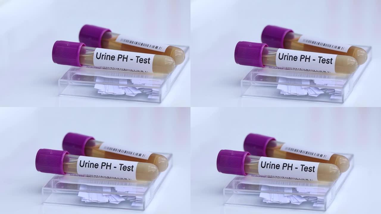 尿液酸碱度检测从尿液中寻找异常，在实验室进行尿液样本分析