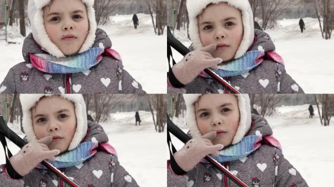 一个冬天穿着滑雪服，手里拿着棍子的小女孩，她的嘴唇上有疮，冬天脸上有疱疹，免疫力下降。疱疹病毒引起的