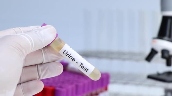 尿液检查从尿液中寻找异常，在实验室中分析尿液样本