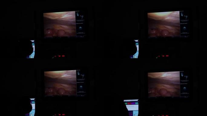 4k监视器内窥镜对手术室库存视频的病人的反射。