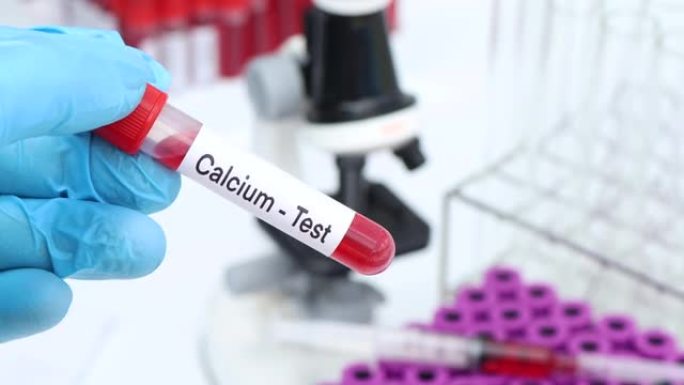 钙测试以寻找血液中的异常