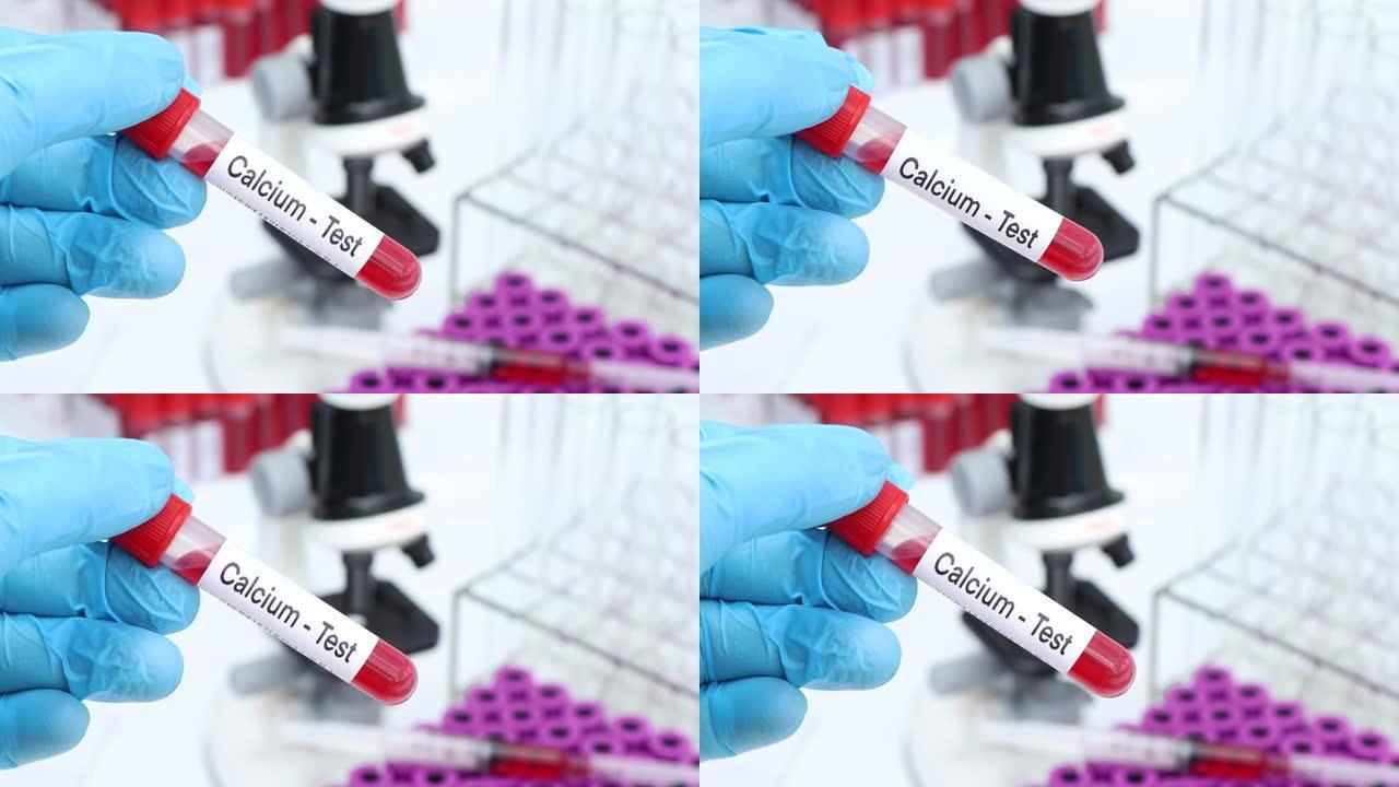 钙测试以寻找血液中的异常