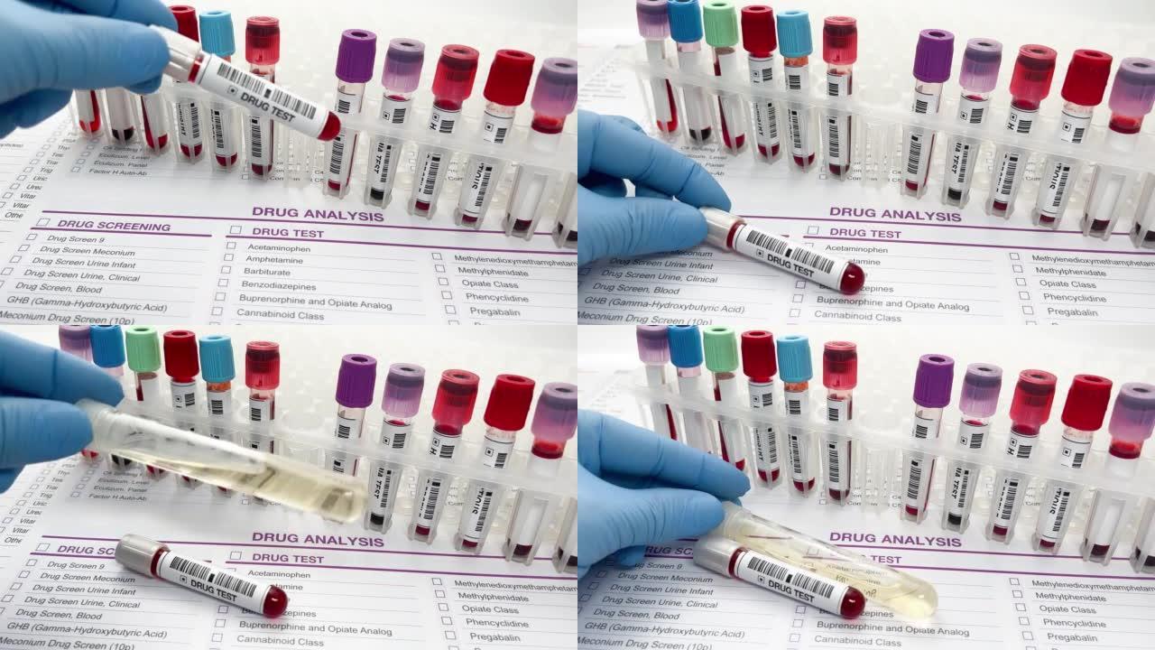 医生用尿液分析和血液样本进行药物测试或酒精超过医疗报告