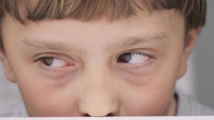 9岁高加索男孩的眼睛特写。