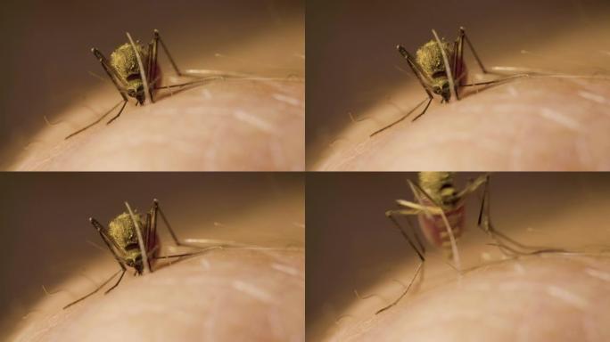 腹部充满红色血液的雌性蚊子正在从男人的手中吸出