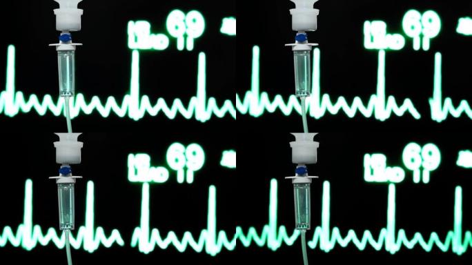 滴注生理盐水，滴注医用灌注关闭设备在临床背景，医疗设备，生理盐水溶液IV滴注液体在医院输液。手术室静