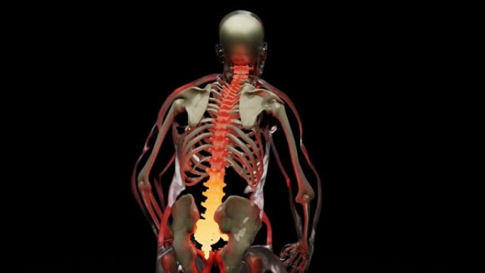 脊髓脊柱颈椎人体骨骼系统解剖概念。骨干上的红色，痛苦的脊柱的医学上准确的插图，男性受伤的骨干，抓举，