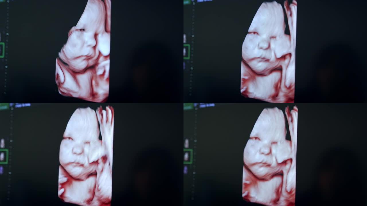 超声波设备屏幕上婴儿的图像。特写。怀孕妈妈的肚子里有孩子的黑色监视器。