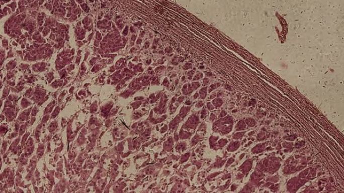 在显微镜下撞击和肿胀的人肝细胞的显微照片